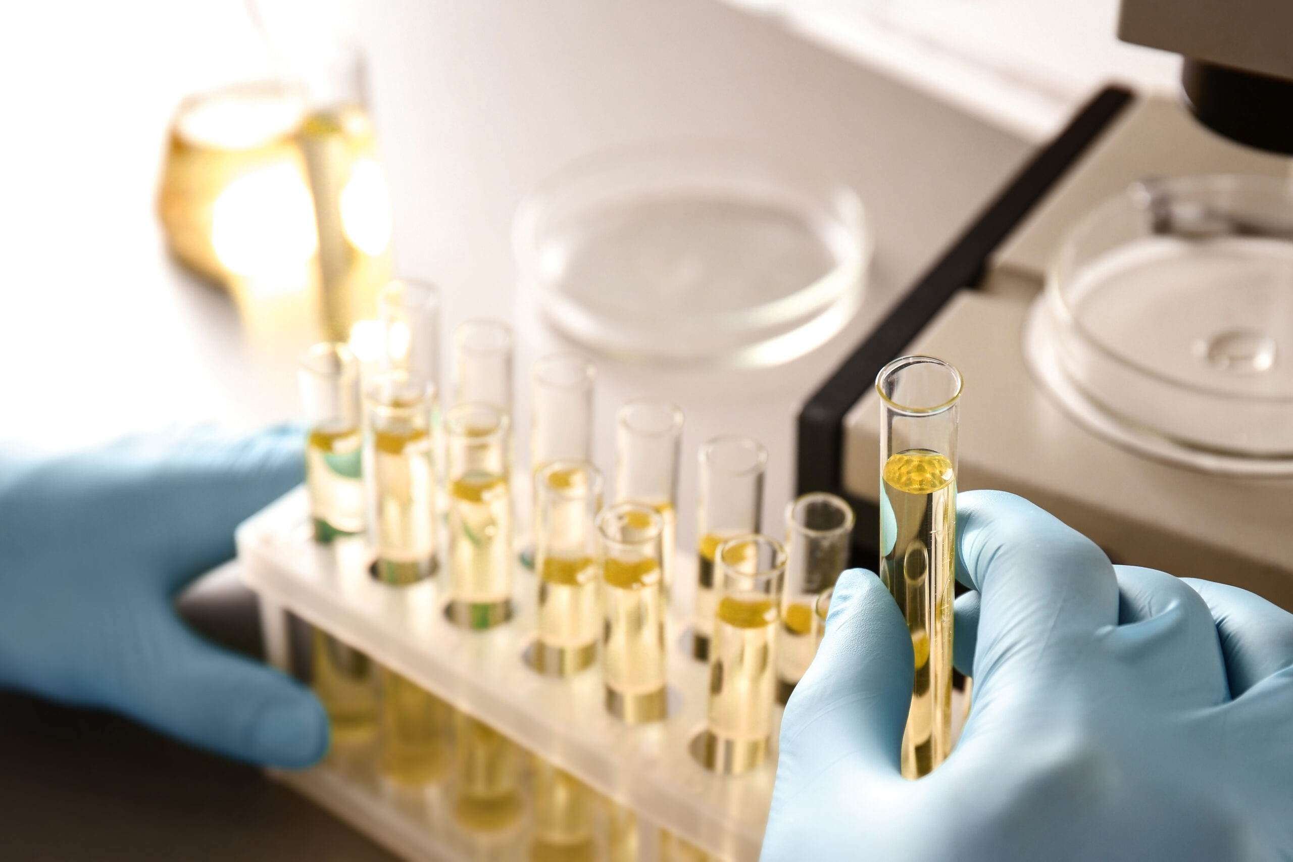 RNA-Urinanalyse könnte Früherkennung revolutionieren