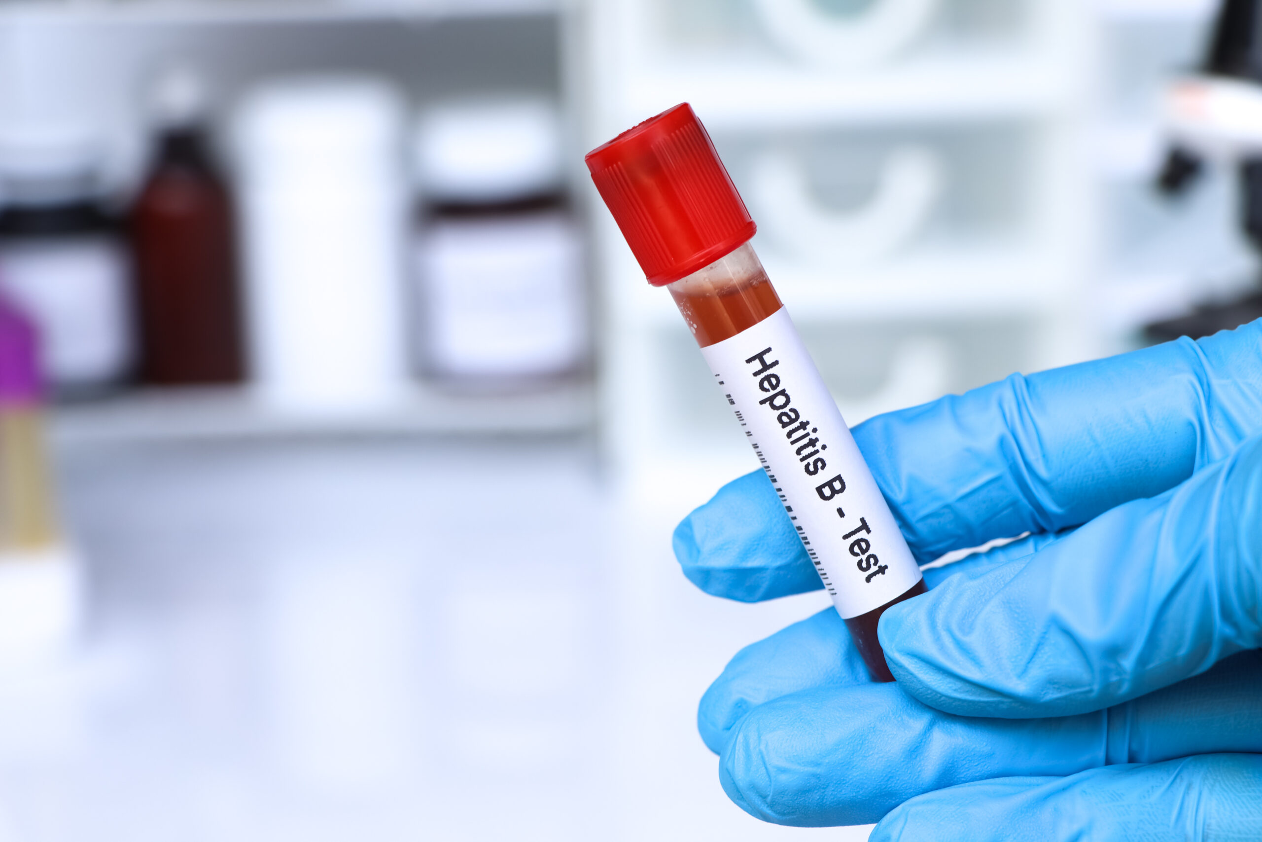Erwachsenen fehlt Hepatitis B-Schutz