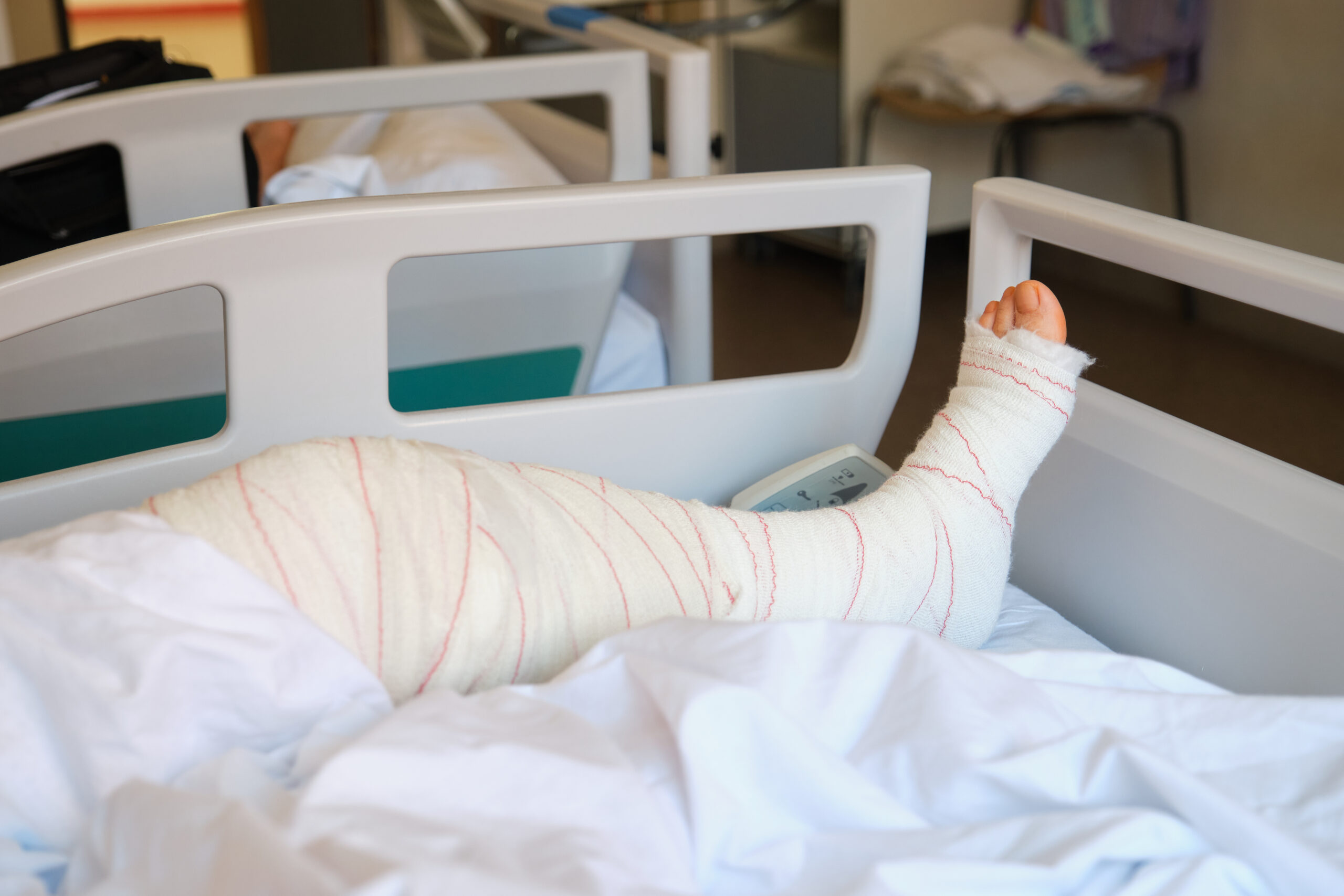 Bein mit Stützverband. Der Patient liegt augenscheinlich in einem Krankenhausbett.