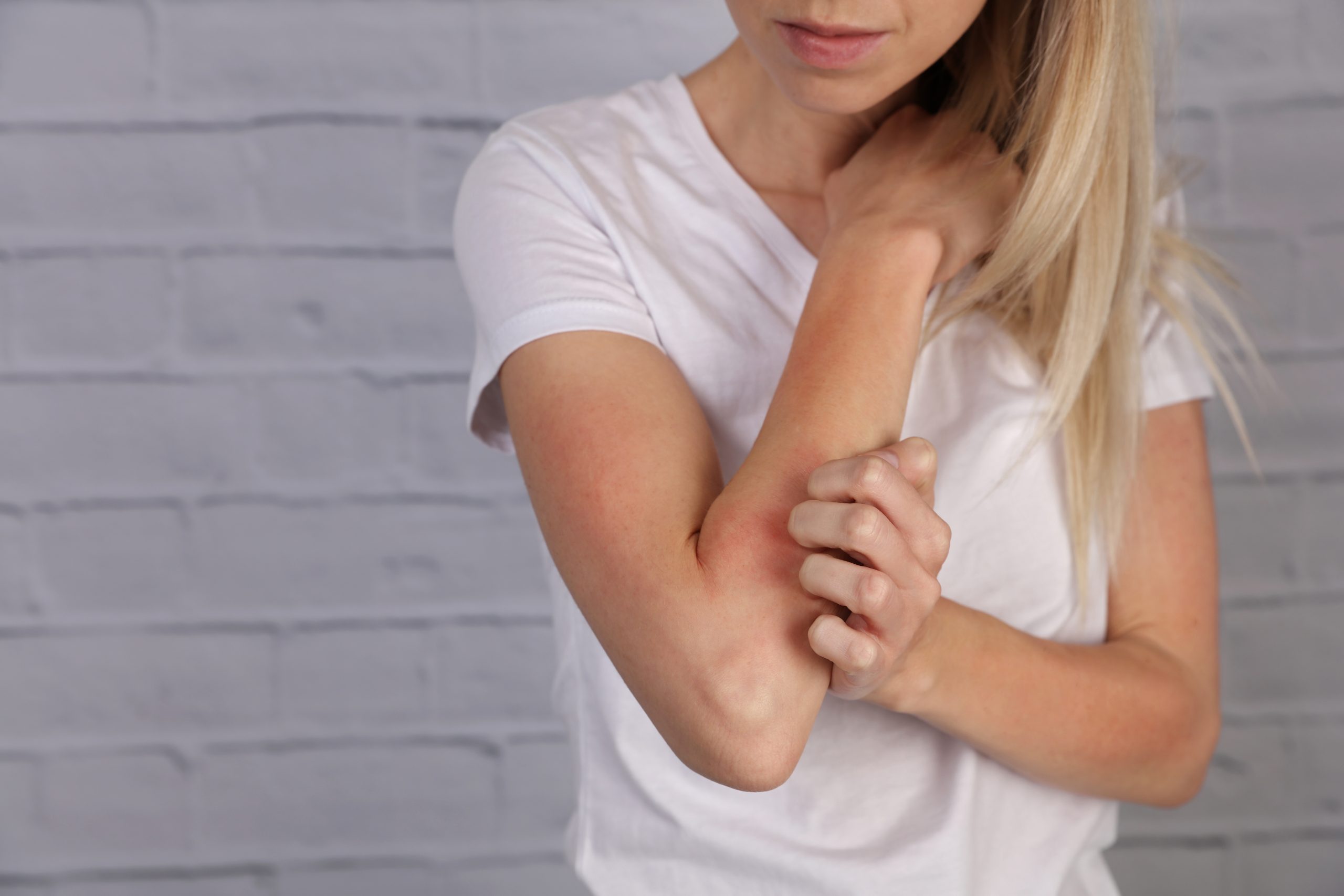 Entzugssymptome nach Cetirizin-Langzeitanwendung