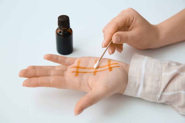 Auf der Handinnenfläche wird mit einem Wattestäbchen ein Gitter mit brauner Flüssigkeit gezeichnet.