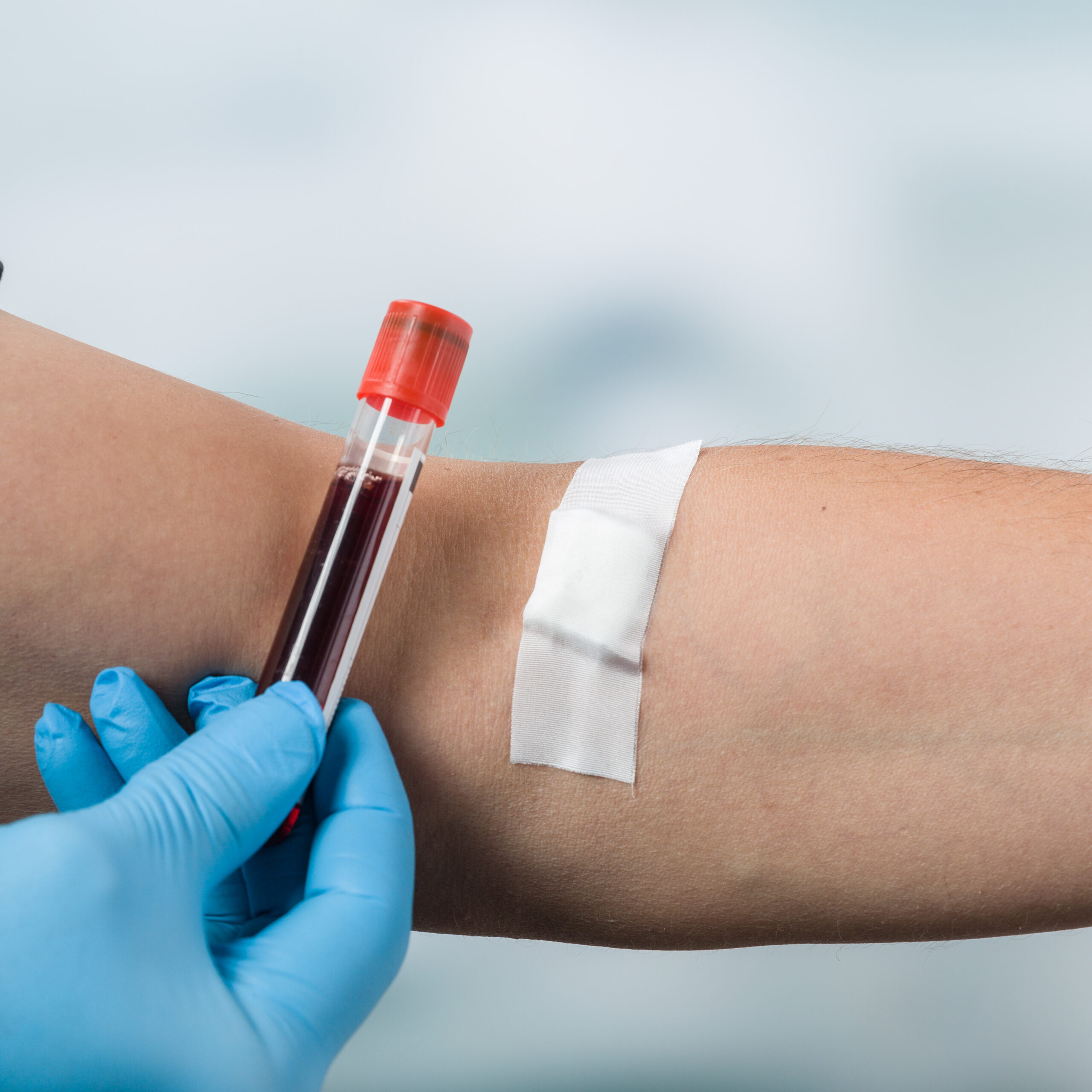 Vor einen Arm mit Pflaster kurz unter der Beuge wird eine Phiole mit Blut gehalten.