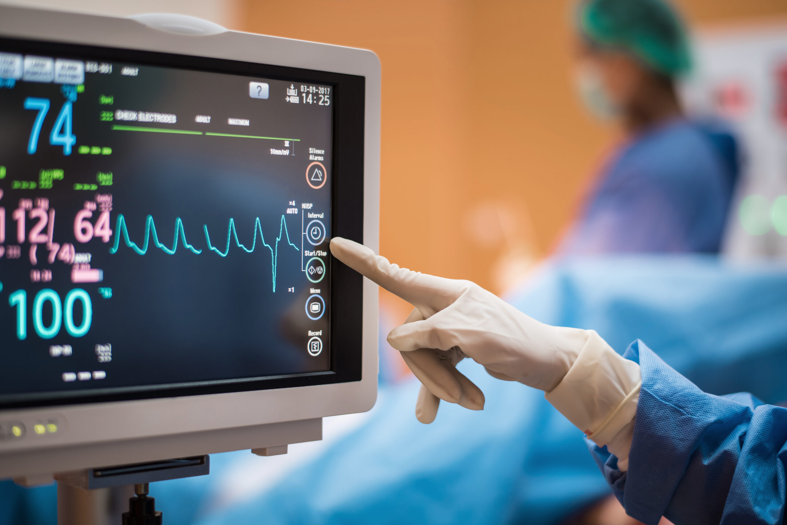 Finger zeigt auf ein EKG.