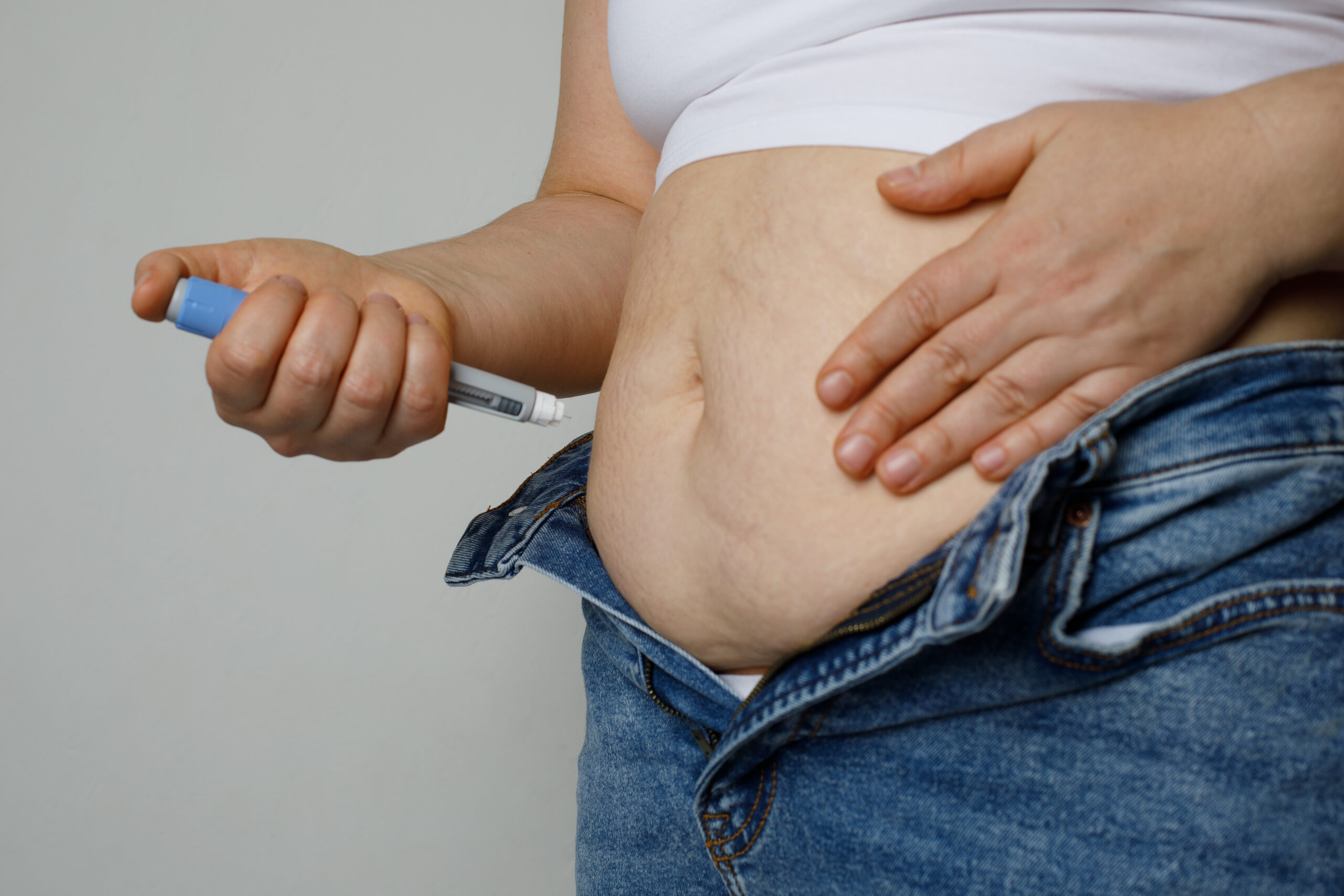 Eine adipöse Frau steht mit freiem Bauch da und macht sich bereit ein GLP-1-Analogon in den Bauch zu injizieren. Sie trägt eine Jeans und ein weißes Top. Ihr Gesicht sieht man nicht.