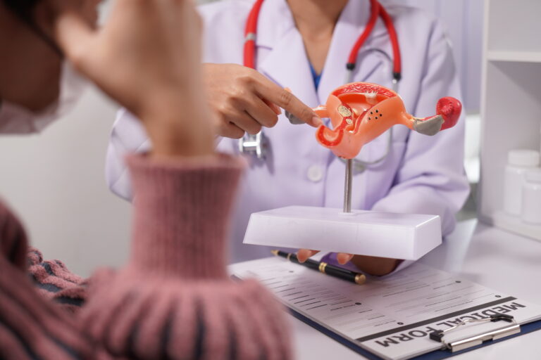 Frauenärztin mit Gebärmuttermodell