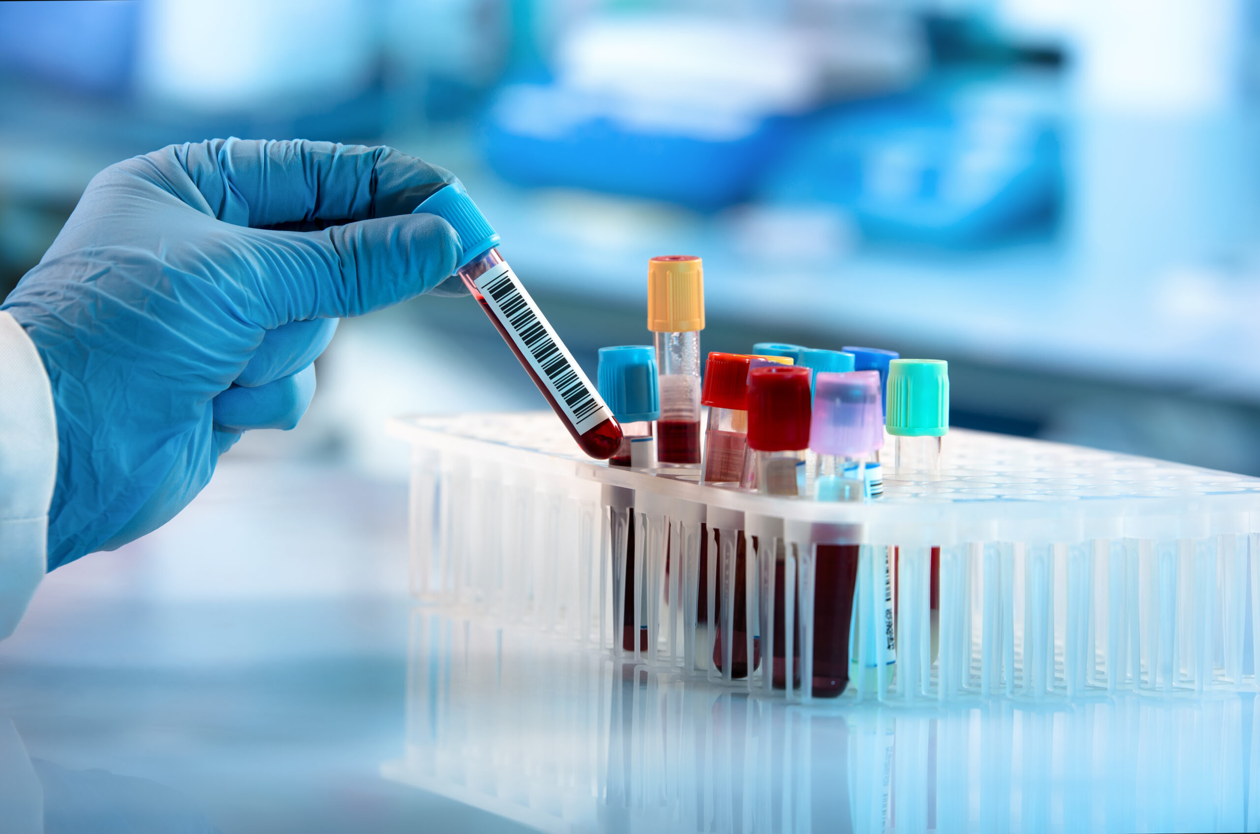 Molekül im Blut könnte Schlüssel zu einem langen Leben sein