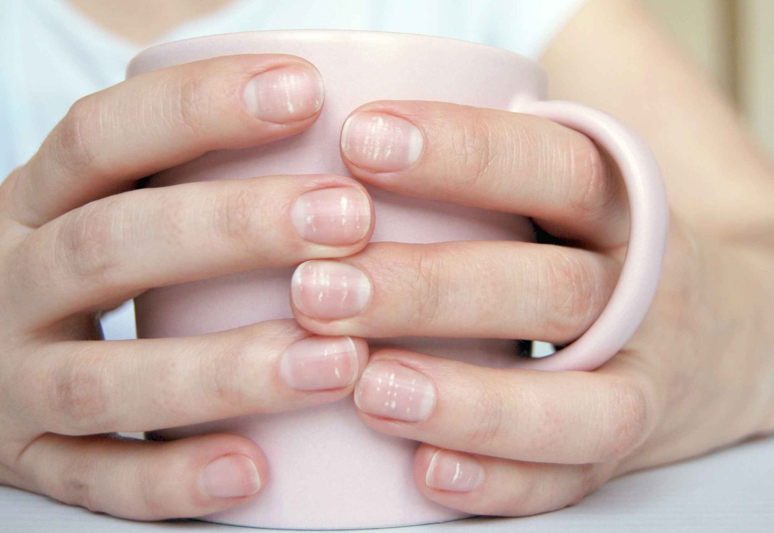 Symbolbild: Eine rosa Tasse wird von zwei Händen umschlossen. Die Fingernägel haben weiße Flecken.