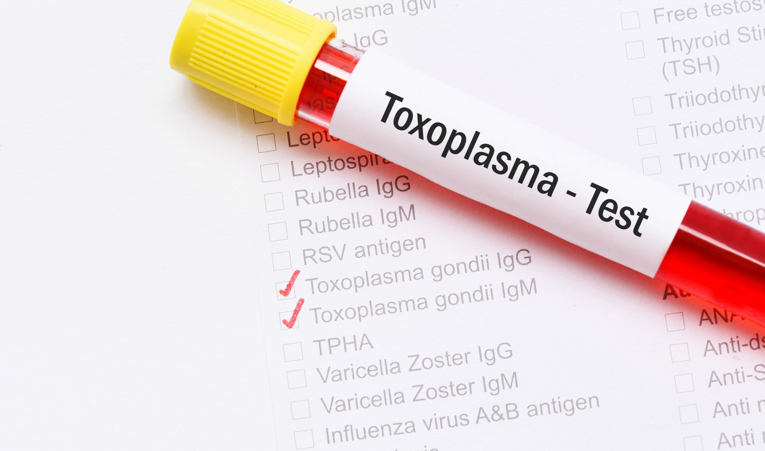 Symbolbild: Ein Blutröhrchen auf dem Toxoplasma steht, daneben ein positiver Laborbefund.