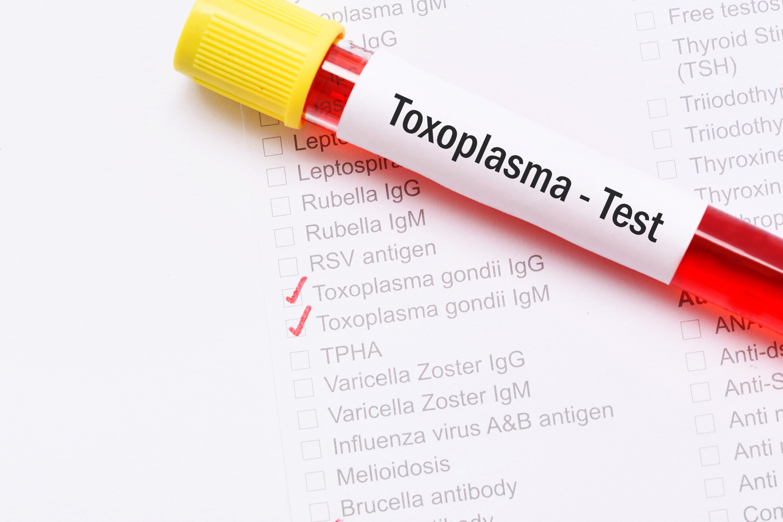 Selbstzerstörung als Schutz: Wie Immunzellen Toxoplasma stoppen
