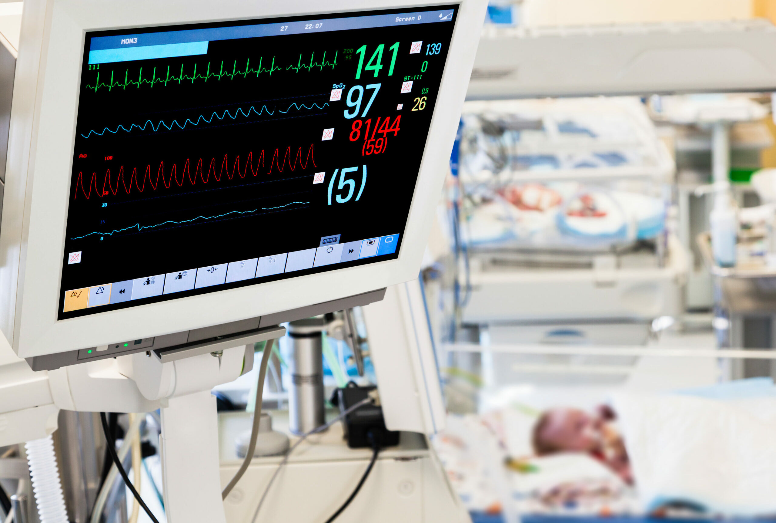 Symbolbild: Ein Monitor zeigt Vitalfunktionen an. Daneben liegt ein Säugling.