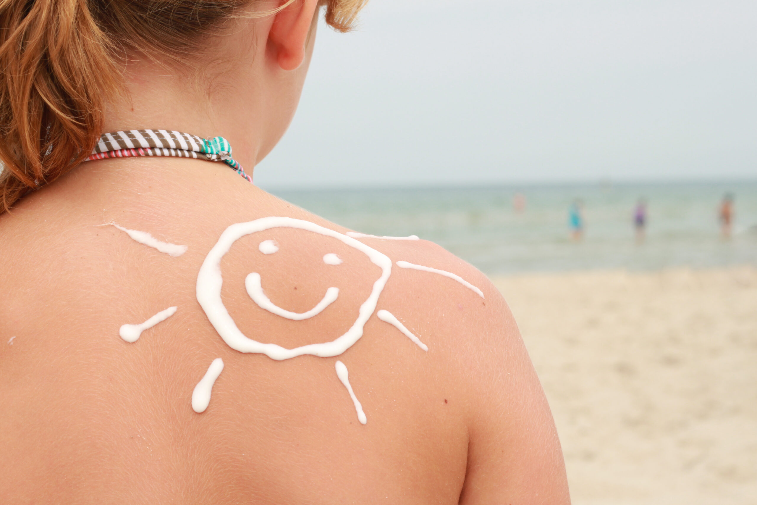 Symbolbild: Kinderschulter am Strand, auf die Haut wurde mit Sonnencreme eine Sonne aufgetragen.