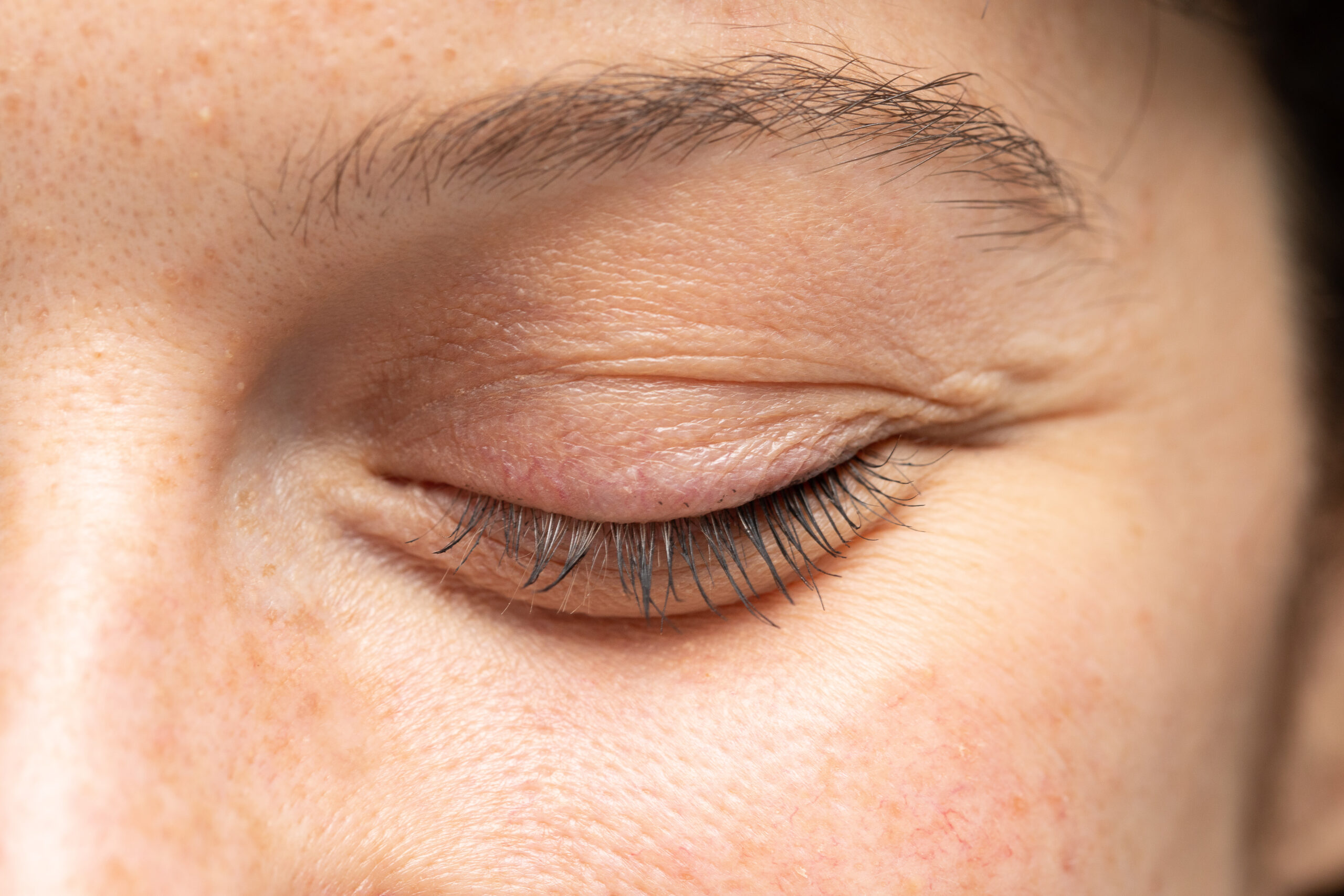 Symbolbild: Nahaufnahme von einem geschlossenen Auge.
