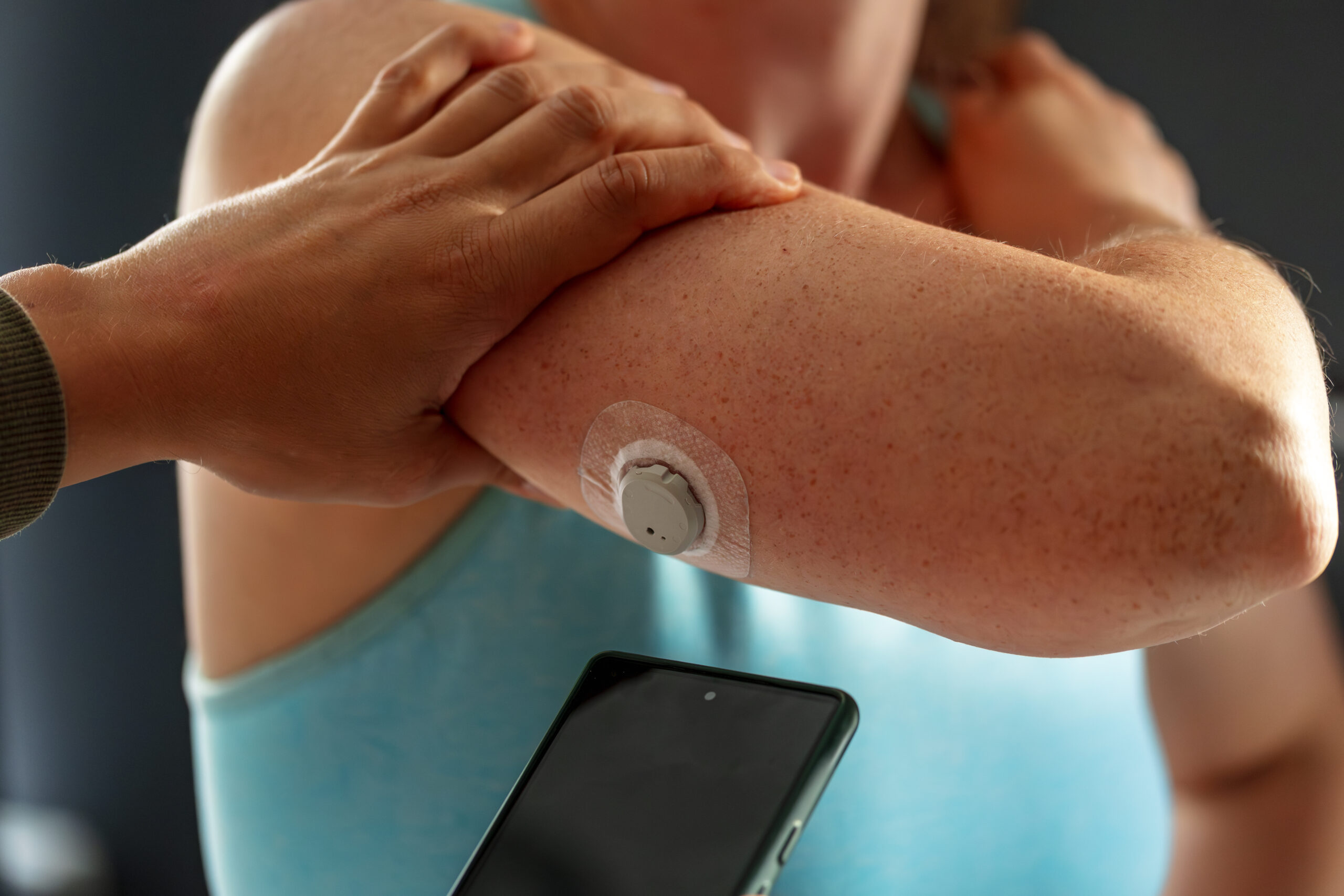 Symbolbild: Eine Frau trägt einen GLucosesensor und hält ein Handy daran.