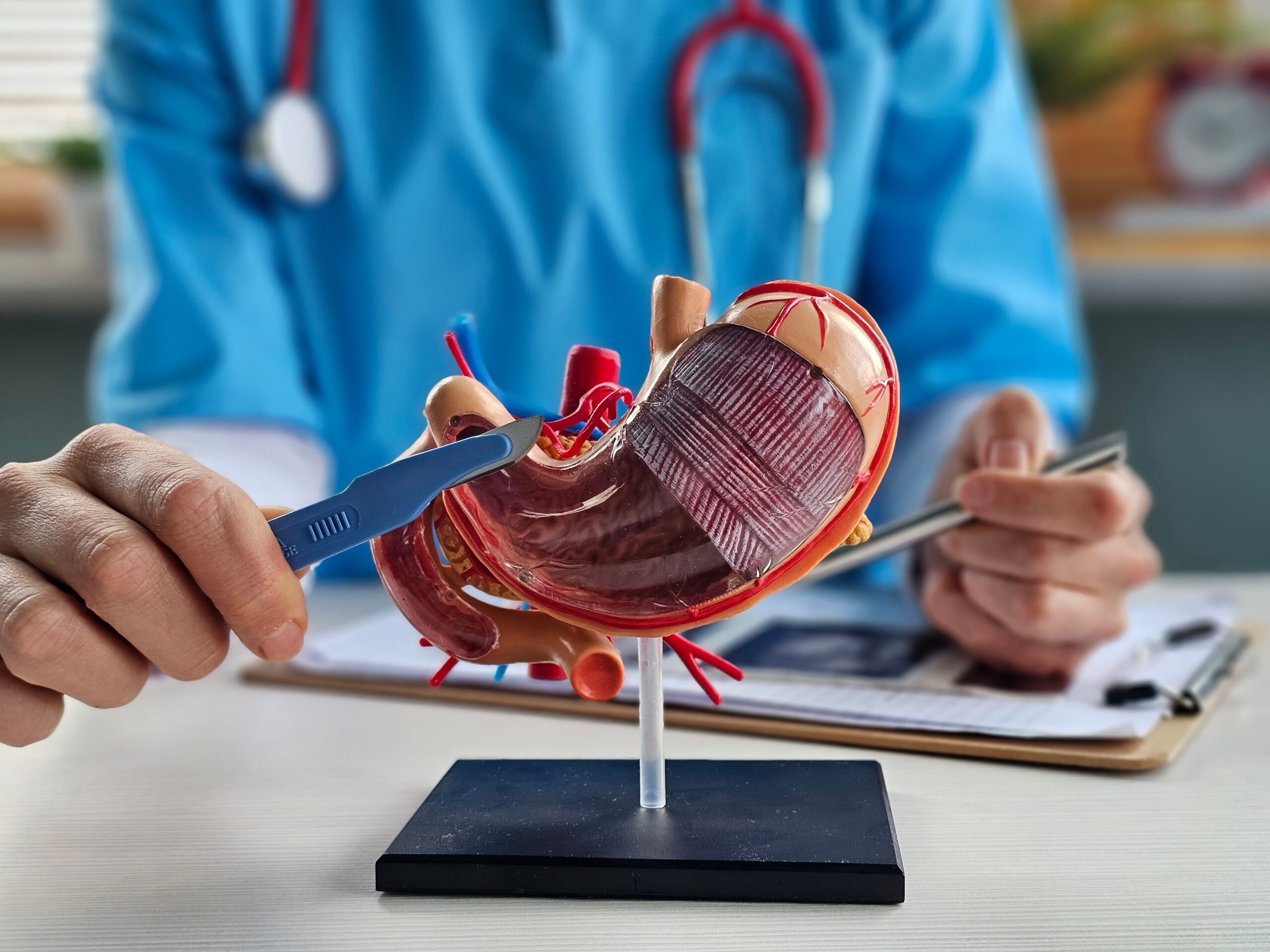Symbolbild: Eine medizinische Fachperson zeigt an einem anatomischen Magenmodell die Lage und den Aufbau des Magens.